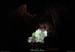 20130508_baumescure_sortiew4